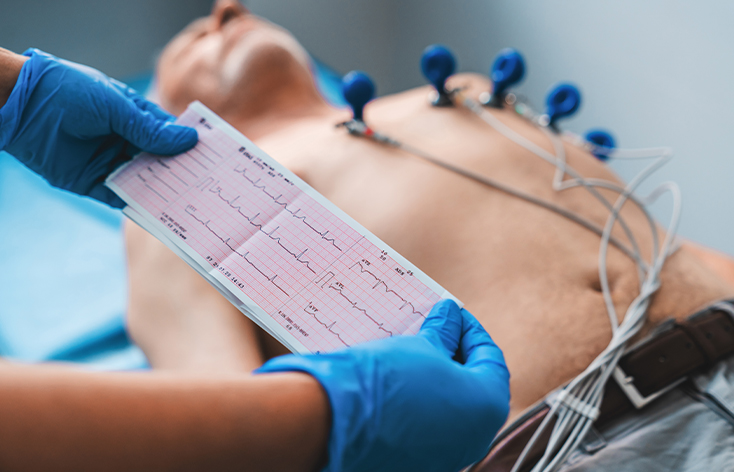 ECG Test in Ludhiana