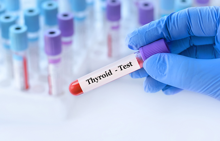 Thyroid Test in Ludhiana