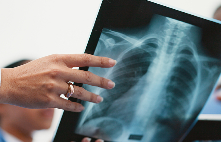X Ray in Ludhiana