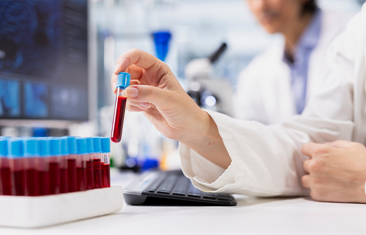 Blood Test in Ludhiana