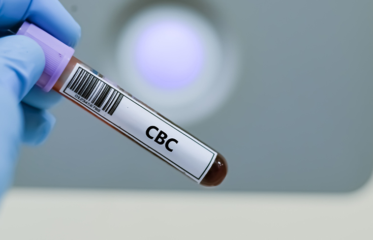 CBC Blood Test in Ludhiana