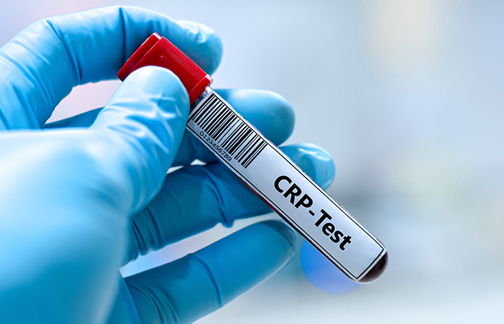 CRP Test in Ludhiana